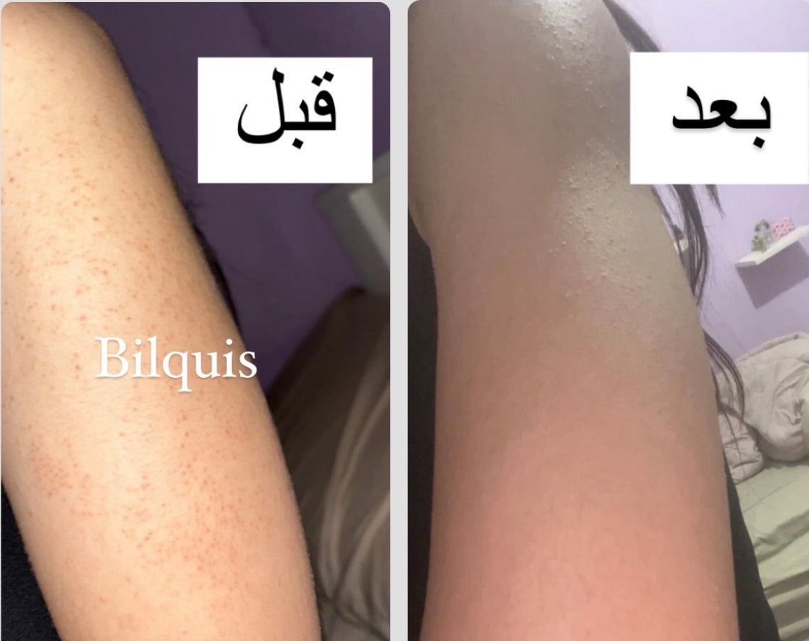 باكيج البنت الصحية بالصيف