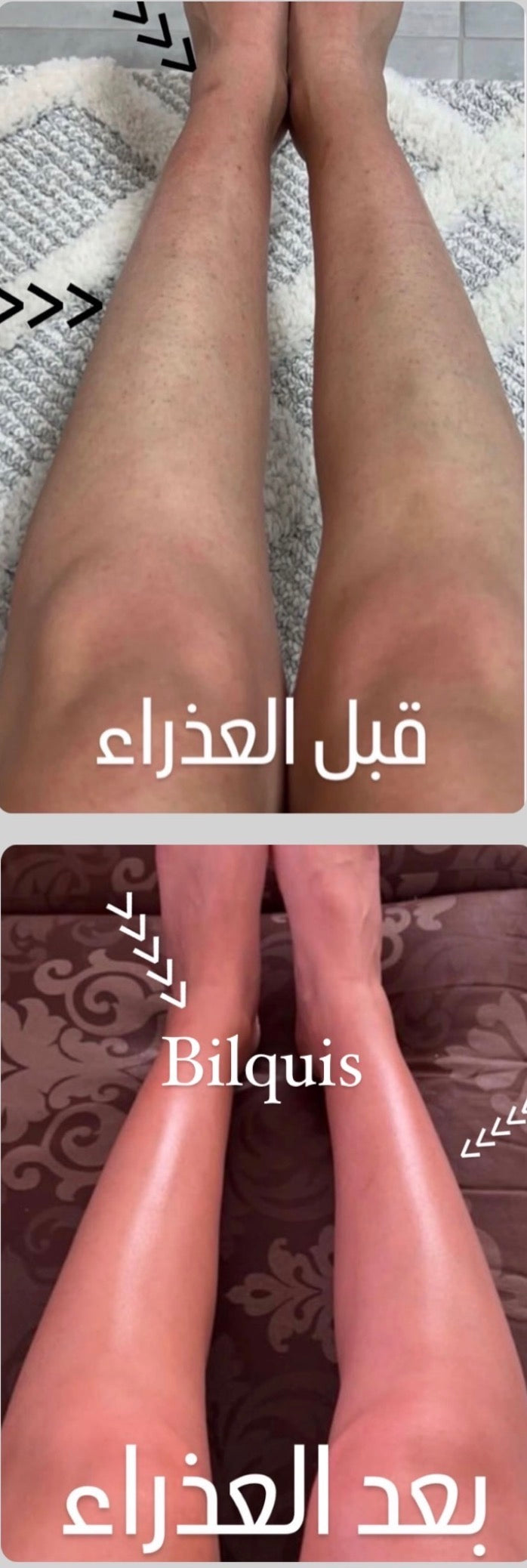 باكيج البنت الصحية بالصيف