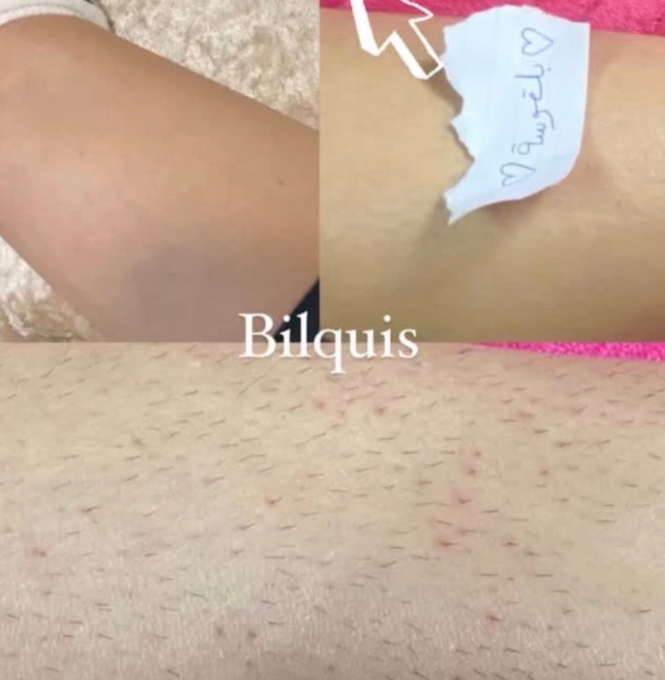 باكيج البنت الصحية بالصيف